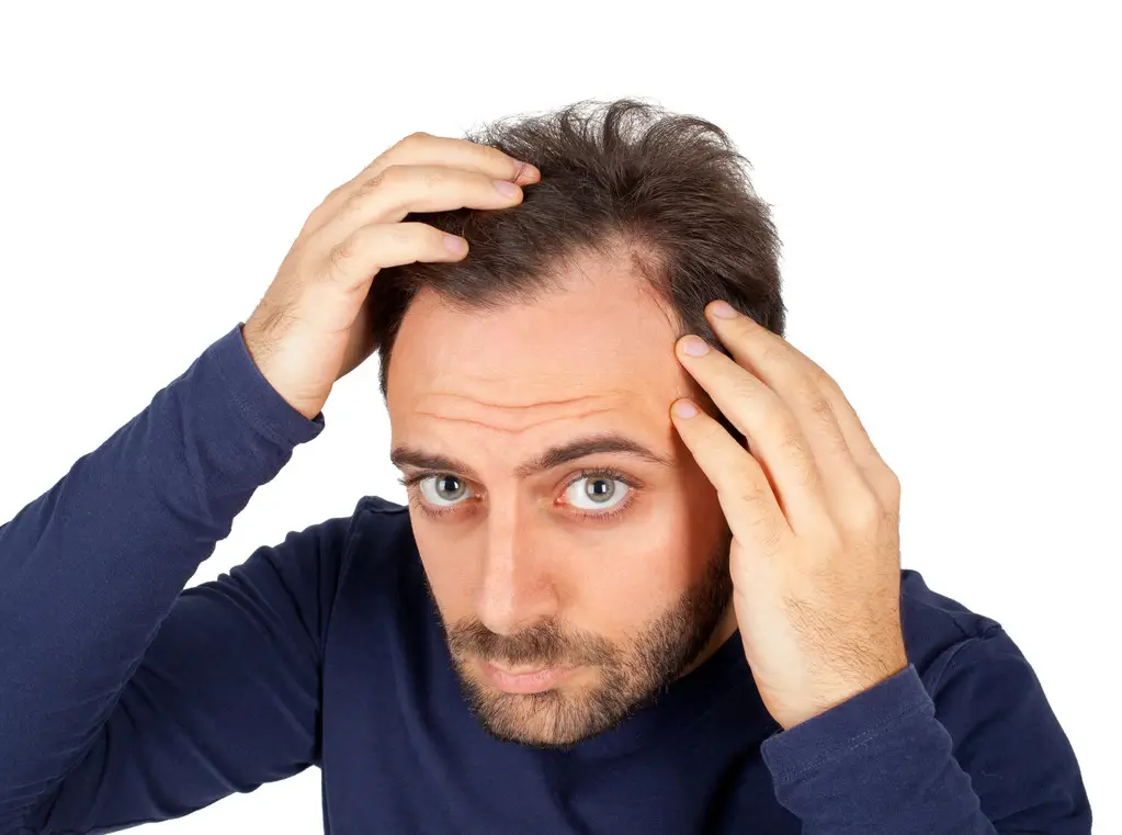 Is Minoxidil the Right Solution for Your Hair Loss