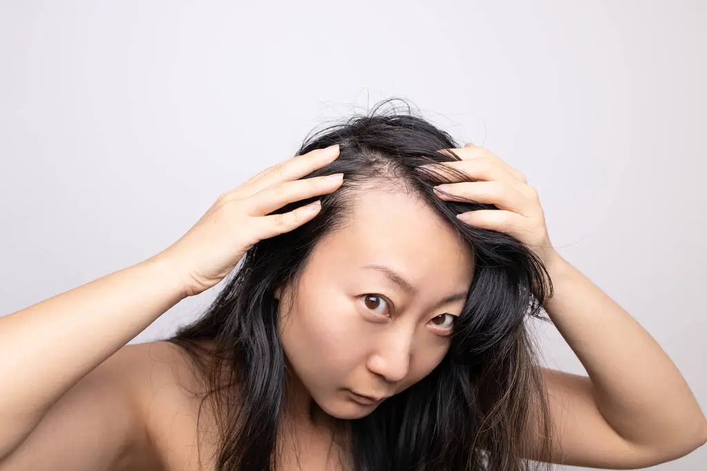 Top 5 Proven Hair Growth Solutions That Actually Work for Men