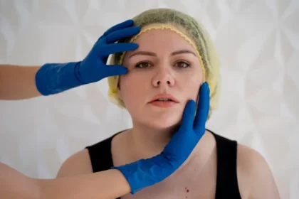 Lift Depressed Scars Using New-Age Skin Correction Options